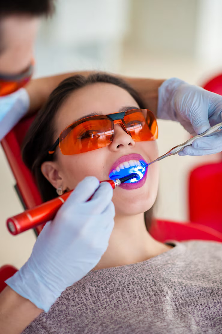 Safe Teeth Whitening Frequency